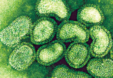 صوره مجهريه لفيروس (H1N1)