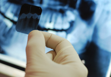 an image of a hand holding a dental x-ray